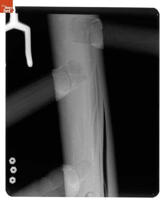 X-Ray of "Brewster" Chair, Imaged 1977