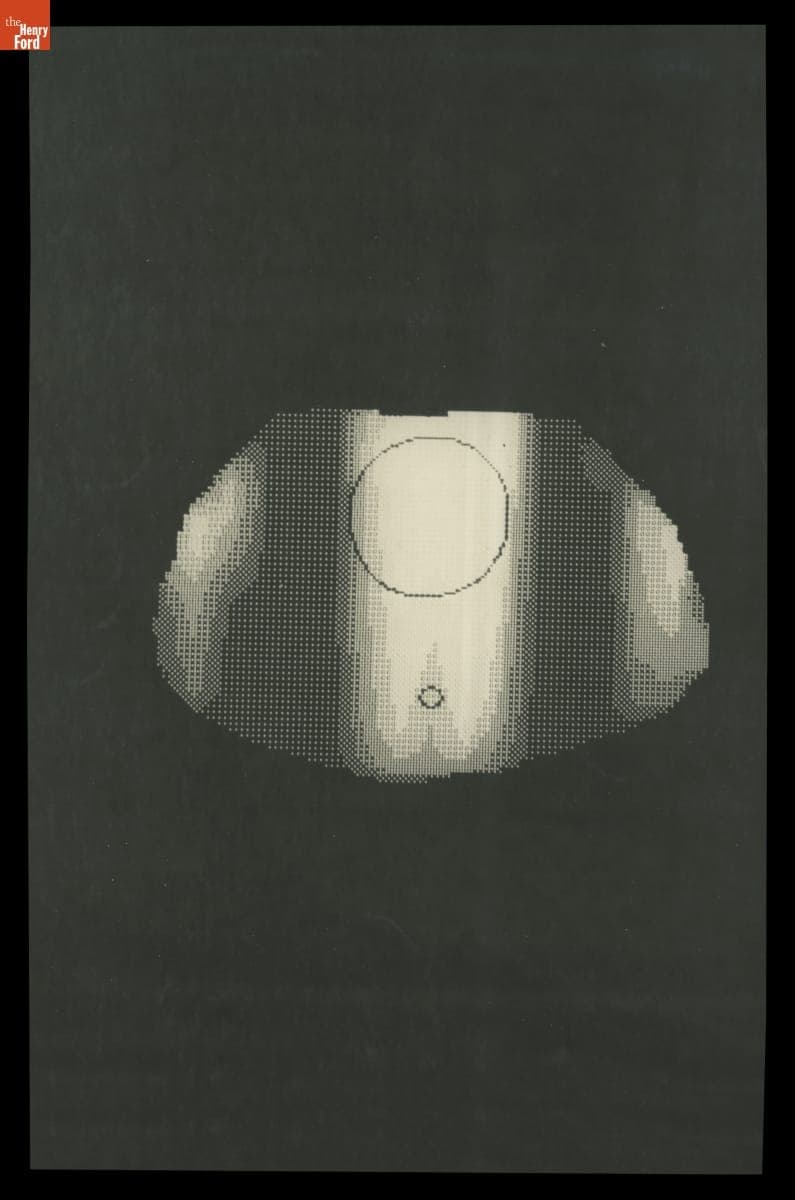 Computer-Generated Image for Planning Radiotherapy Treatment, 1973