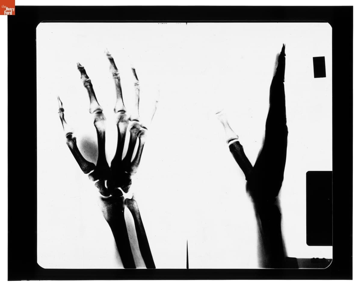 X-Ray Images of Lillian Schwartz's Hand, November 1974