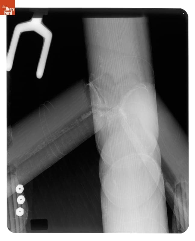 X-Ray of "Brewster" Chair, Imaged 1977