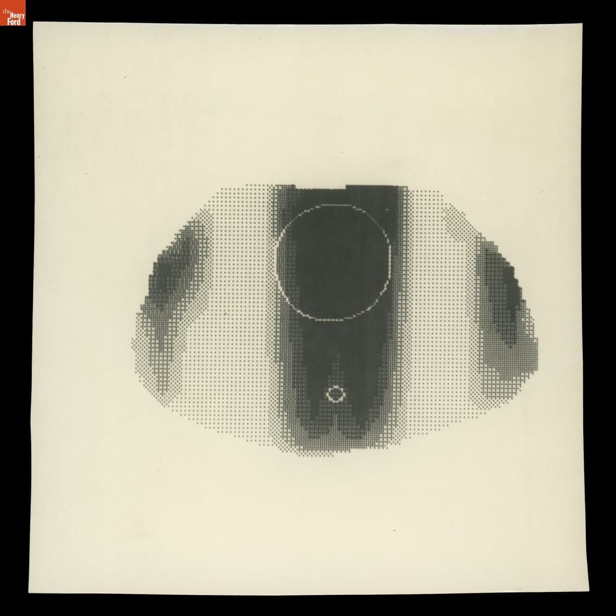 Computer-Generated Image for Planning Radiotherapy Treatment, 1973