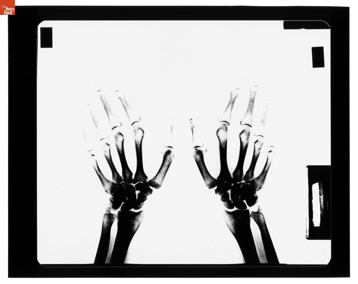 X-ray images of Lillian Schwartz’s hands, November 1974.
