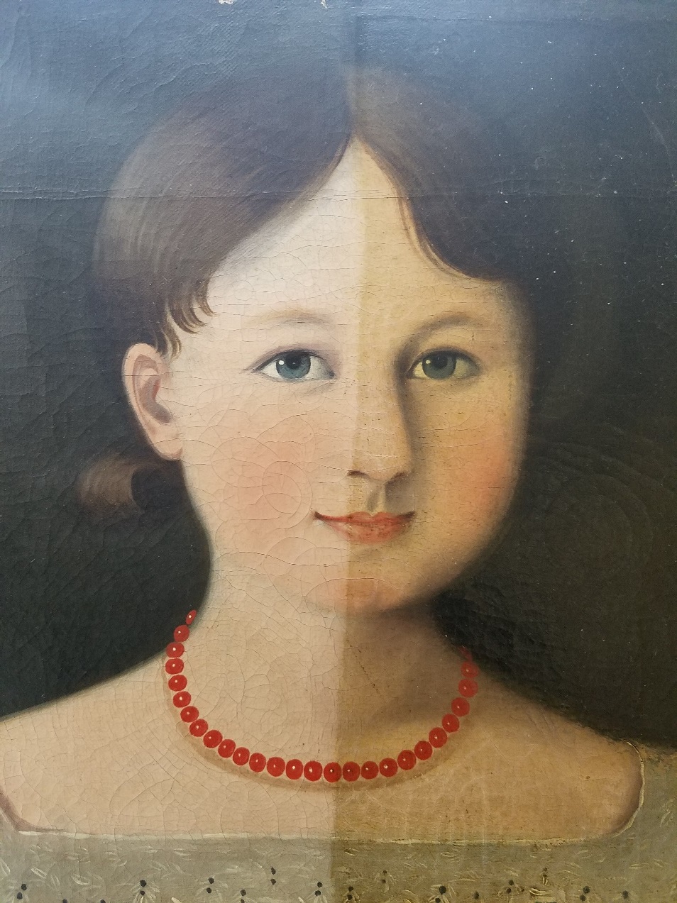 Painting of girl's face with paint on left side lighter and less yellowed than on right side