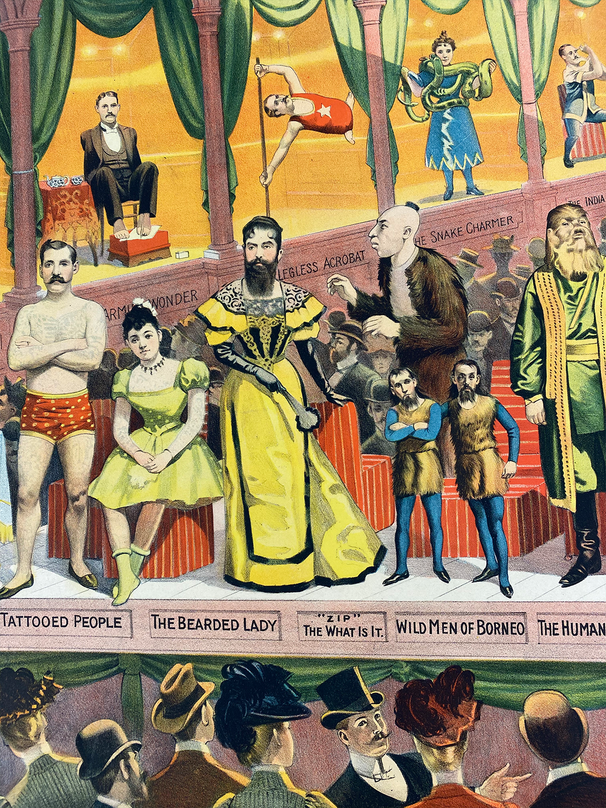 This 1898 Barnum and Bailey’s circus poster shows a woman with hirsutism who was placed on display